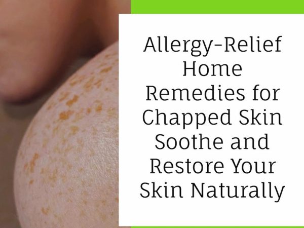 Home Remedies for Relieving Allergy-Related Chapped or Dry Skin